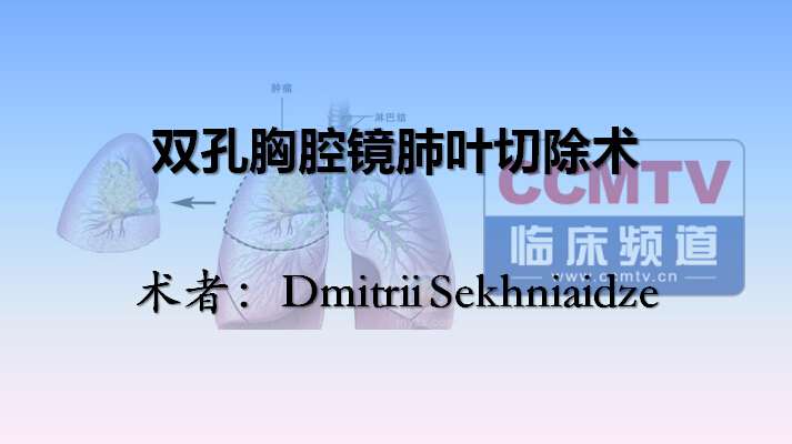 Dmitrii Sekhniaidze：双孔胸腔镜肺叶切除术（含讲解，英语）